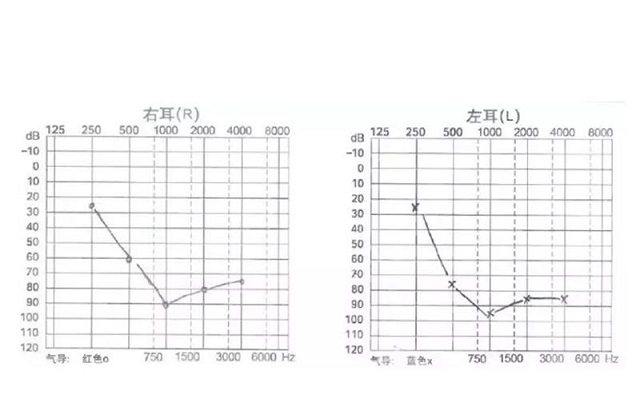 他的智能小聆听，生活充满无限可能